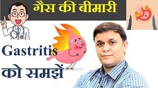 Gastritis or Acidity Causes Symptoms amp Homeopathic Treatment पेट की तकलीफ के कारण लक्षण और उपचार [upl. by Jaella]