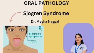 Sjogren Syndrome  Sicca Syndrome  Oral Pathology  Easiest Explanation [upl. by Yesak204]