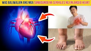 TOP 5 SINTOMAS ng ENLARGED HEART [upl. by Lahsram]