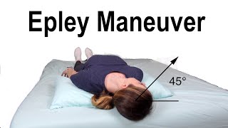 Epley Maneuver to Treat BPPV Dizziness [upl. by Ornas]