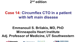 Case 14 Manual of CTO Interventions  Circumflex CTO in a patient with left main disease [upl. by Long]