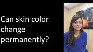 Can your skin tone change from dusky to fair  Dr Aanchal [upl. by Bilak618]