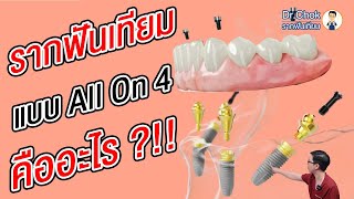 ฝังรากฟันเทียม แบบ All On 4 เปลี่ยนชีวิต l คลายปัญหารากฟันเทียมกับหมอโชค [upl. by Atteynot]