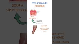 CELLULITIS ERYSIPELAS [upl. by Ajuna169]