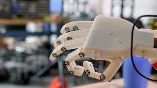 A Robotic Hand with Brains [upl. by Freedman854]