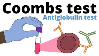 Blood Transfusions ABO amp Rh Compatibility  Medical Tutorial [upl. by Florinda]