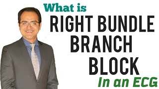 Right Bundle Branch Block RBBB ECG Interpretation Explained How to identify RBBB BlockUSMLE NEET [upl. by Danielson357]