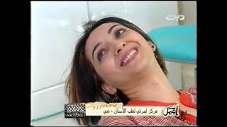 أنت أجمل  حشوات تجميلة للاسنان مع د مجد ناجي [upl. by Mollie593]