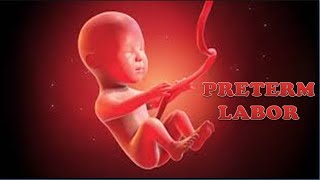 PRETERM LABOR  Define Causes Pathophysiology Diagnosis amp Management  Preterm Labor TOCOLYTICS [upl. by Vladimar175]