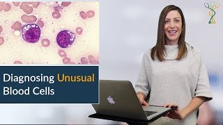 Identifying Strange Blood Cells  Pathology Board Review [upl. by Garald]