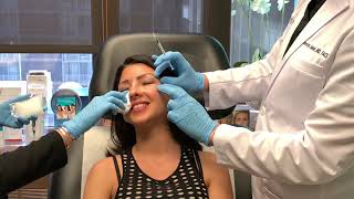 Prevent Smile Lines and Wrinkles Botox to Crows Feet [upl. by Bertero]