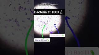 Gram positive amp Gram positive bacteria  Gram stain  bacteria shorts viralshorts lab bacteria [upl. by Ahsienet]