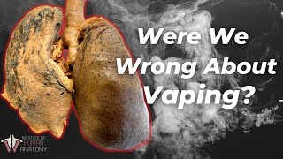 What We DO and DONT Know About Vaping [upl. by Mutz]