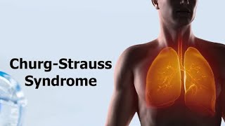 Churg Strauss Syndrome  Eosinophilic Granulomatosis With Polyangiitis Causes and treatment [upl. by Kcirdneh]