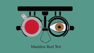 Maddox Rod Test [upl. by Lea]