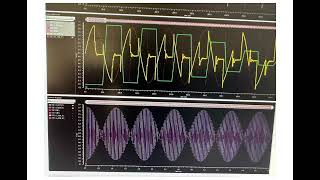 Analog IC design SAR ADC design Based on smic18 process 10 bit 20M asynchronous sarADC [upl. by Sileray]