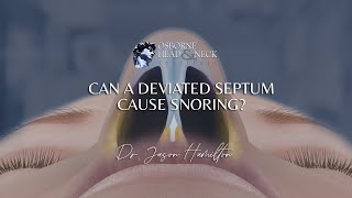 Can a deviated septum cause snoring [upl. by Sayette129]