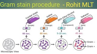 Gram stain procedure gram staining steps gram positive and gram negative [upl. by Suiramed]