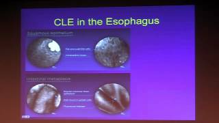 What is Barretts Esophagus  Dr Raman Muthusamy [upl. by Fabyola]