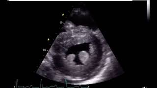 Make the Diagnosis  interesting ECHO Case [upl. by Alene]