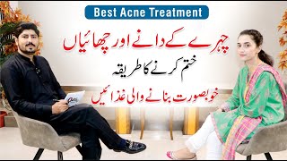 Pimples and Acne Treatment At Home  Skin Care Routine  Dr Huria Arooj  Dr AR Madha [upl. by Pius]