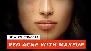 How To Conceal Red Pimples  Acne For An Even Skin  Makeup Tutorial by Pallavi Symons [upl. by Latrell94]