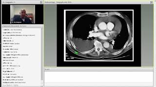 Step2 2CK IM Pulmonary Medicine [upl. by Ednalrym]