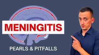 BACTERIAL MENINGITIS IN ADULTS SYMPTOMS CAUSES DIAGNOSIS AND TREATMENT [upl. by Palma]