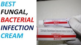 Candiderma Cream Review  BEST Cream FOR Infections [upl. by Dubenko599]