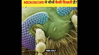 How things look under microscope MRINDIANHACKER CrazyXYZ [upl. by Ras]