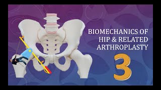 Hip Joint Biomechanics and arthroplasty Simplified Basics Part 3 of 3 [upl. by Allin]