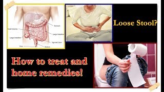 Loose Stool – Causes Treatment Home Remedies [upl. by Sholem]