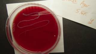 Gamma Hemolysis Staphylococcus epidermidisBlood Agar [upl. by Aldous373]