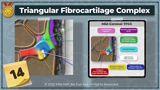 KOR Anatomy14 Triangular fibrocartilage complex TFCC wrist MRI [upl. by Hilliard]