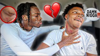 “HICKEY PRANK”🫦ON BOYFRIEND🥴WITH A TWIST💔 [upl. by Charmaine40]