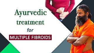 Ayurvedic Treatment for Multiple Fibroids  Swami Ramdev [upl. by Gneh]