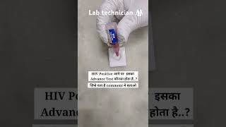 HIV test pathology mbbs dmlt labtechnologist work shorts [upl. by Eyr294]