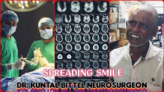 Spreading Smile  Chronic Subdural Hematoma  SDH  Complete Recovery  NEET UG  NEET PG  NEET SS [upl. by Zerla195]