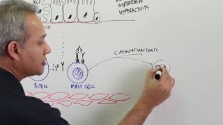 Asthma  Pathophysiology [upl. by Aiceled]