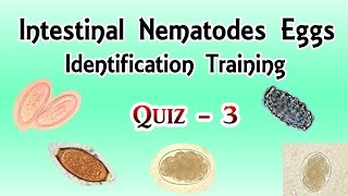 Intestinal Nematodes Eggs Identification Training Quiz 34 [upl. by Joselyn]