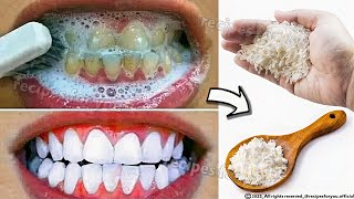 Teeth whitening at home in just 2 minutes  how to whiten teeth at home 100 effective [upl. by Attalie]