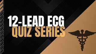 12Lead ECG Quiz Series [upl. by Haon]