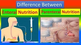 Enteral and Parenteral Nutrition Chapter4 part1 Nutrition BSN 2nd semester kmu slides in pashto v [upl. by Noirod416]