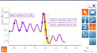 Spirometer Part 2 [upl. by Anesusa]