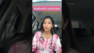 Nephrotic Syndrome  Diagnosis 👨‍⚕️🩺 medicine biology neetpg pgdoctor shorts nephron [upl. by Rox]