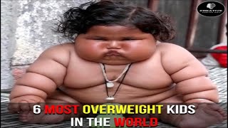 6 Most Overweight Kids in The World [upl. by Sophronia]