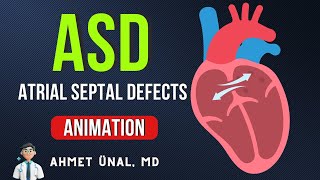 ❤ IS PFO A TYPE OF ASD  🎬 ATRIAL SEPTAL DEFECTS ASD ANIMATION [upl. by Sigvard]