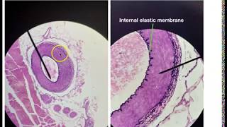 Blood vessel Histology [upl. by Severson708]