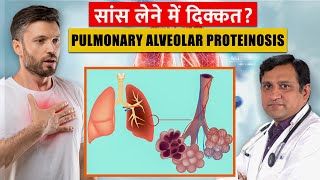 Pulmonary Alveolar Proteinosis  Pulmonary Alveolar Proteinosis Causes  Dr Nikhil Modi [upl. by Harv504]