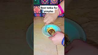 Best totka for pimples hack tips totka tipsforskin pimples youtubeshorts shorts lifehacks [upl. by Imelida]